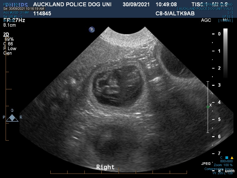 an ultrasound showing Vali's multiple gestational sacs